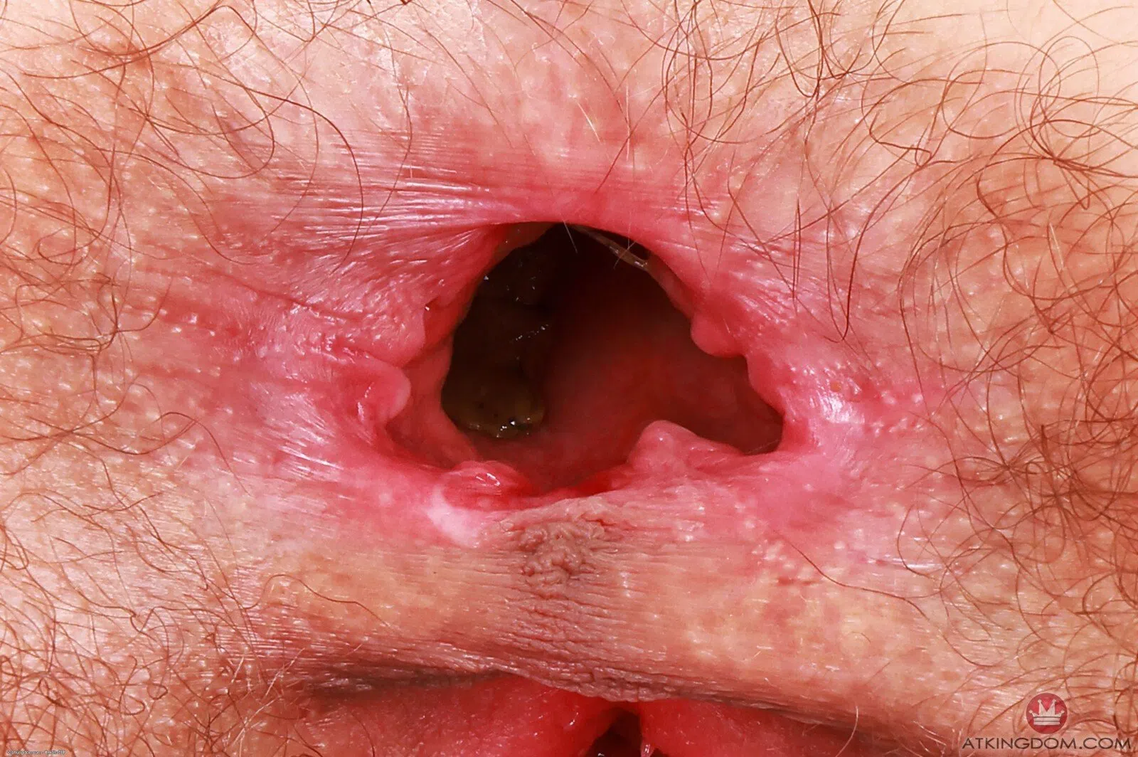 sia-wood-atk-hairy-174647 Of Page 3-11.webp
