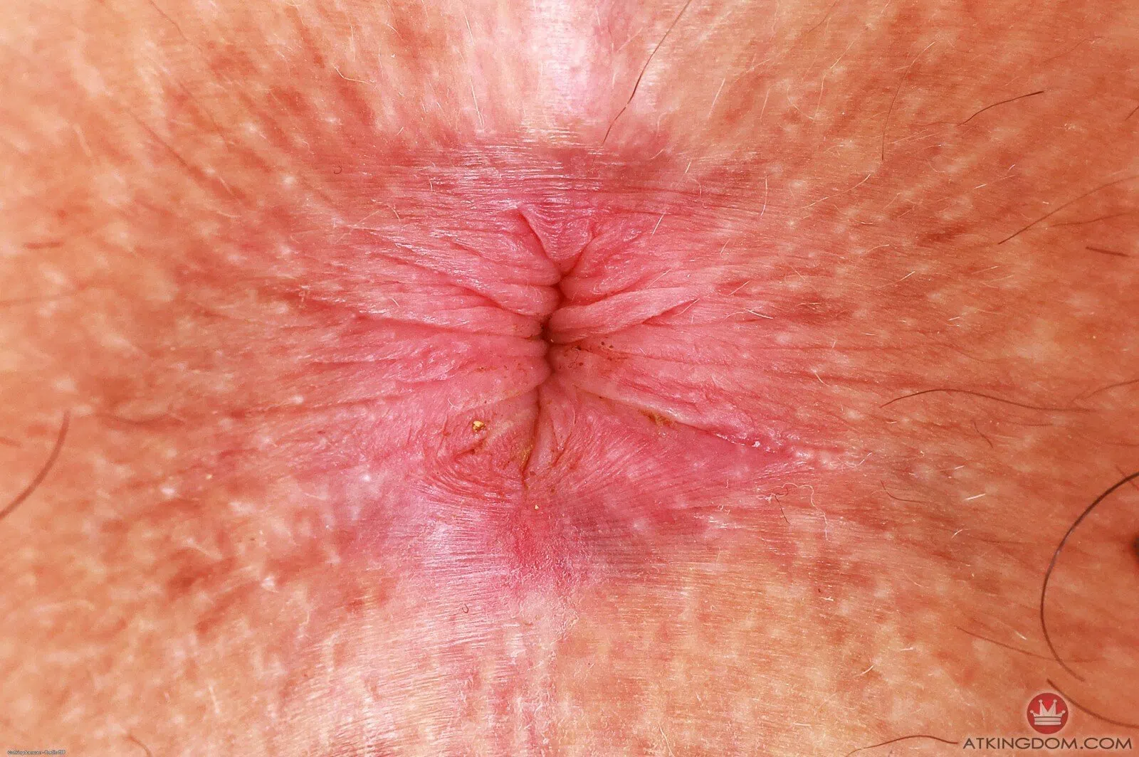 bella-luna-atk-hairy-133702 Of Page 3-12.webp