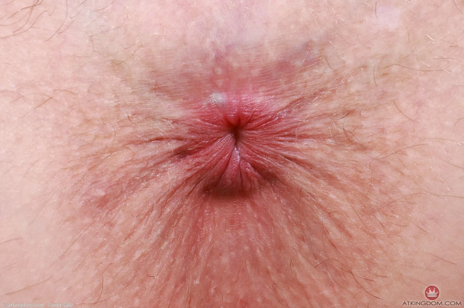 fiona-peaches-atk-hairy-205763 Of Page 2-10.webp